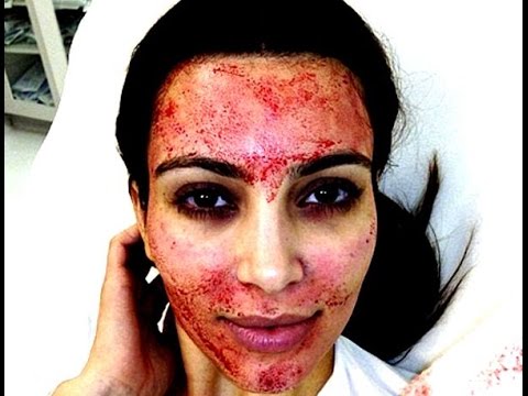 Stem Cell Facial: The celebrity beauty Bio-Hack (Full cosmetic procedure)