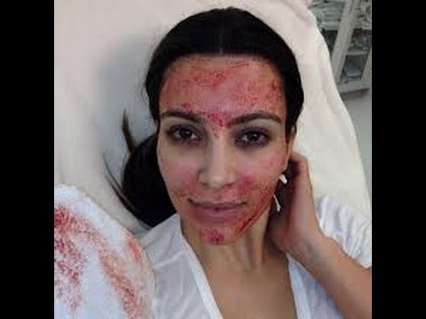 Dr. Jenn explains All Natural PRP Stem Cell Anti-Aging secrets